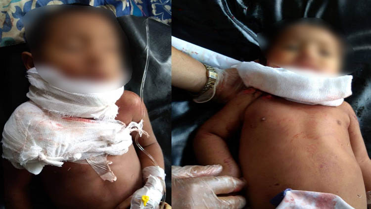 দুই সতিনের ঝগড়াকে কেন্দ্র করে এলোপাতাড়ী কোপে দুই শিশু আহত